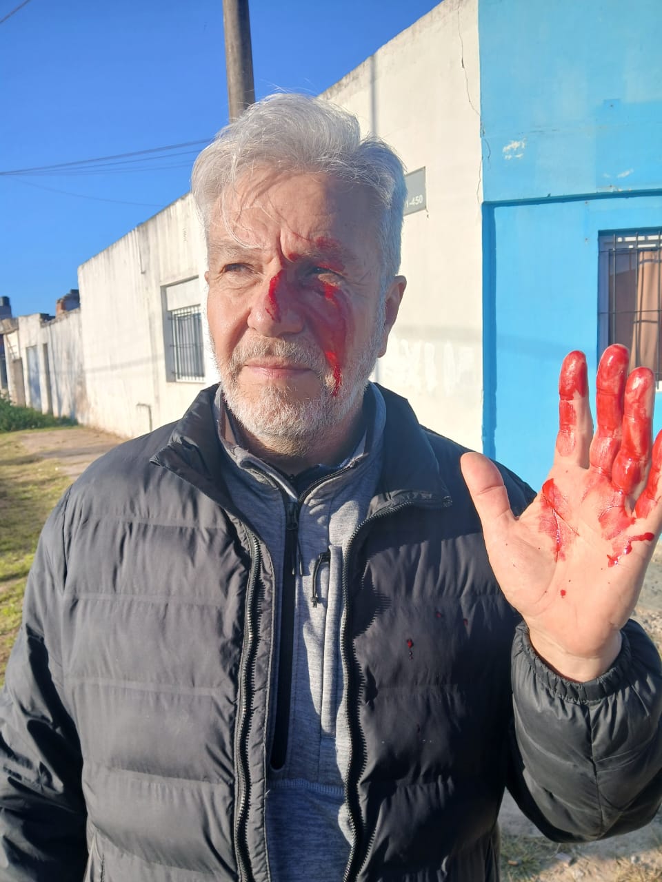 Registro fotográfico posterior al incidente del 3 de julio de 2026