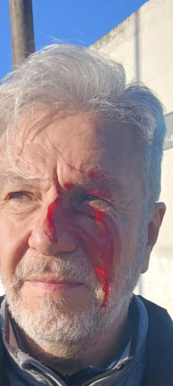 Detalle fotográfico de lesiones visibles luego del incidente